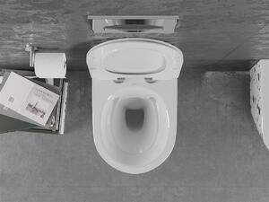 Mexen Lena, závesná WC misa Rimless s duroplastovým sedátkom s pomalým zatváraním, biela-terazzo vzor, 30224096