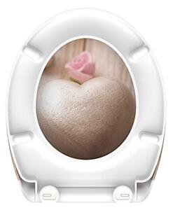 Eisl Sanitär WC sedátko Duroplast Soft Close Romantic 82370