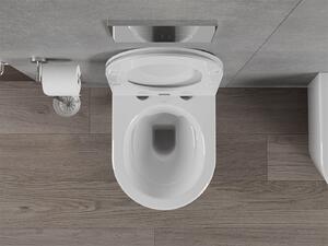 Mexen Rico závesné wc rimless s toaletným Slim sedátkom z duroplastu, biela - 30720300