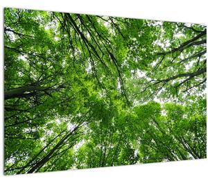 Obraz - Pohľad do korún stromov (90x60 cm)