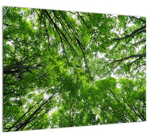 Obraz - Pohľad do korún stromov (70x50 cm)