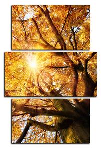 Obraz na plátne - Slnko cez vetvi stromu - obdĺžnik 7240C (90x60 cm)
