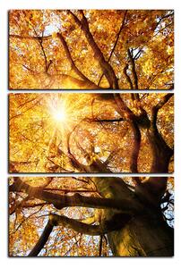 Obraz na plátne - Slnko cez vetvi stromu - obdĺžnik 7240B (90x60 cm )