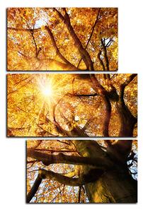 Obraz na plátne - Slnko cez vetvi stromu - obdĺžnik 7240D (90x60 cm)