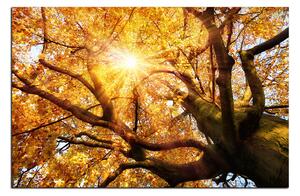 Obraz na plátne - Slnko cez vetvi stromu 1240A (100x70 cm)