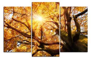 Obraz na plátne - Slnko cez vetvi stromu 1240C (120x80 cm)