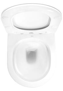 Rea Carlo Mini, závesná WC misa 49x37 cm Rimless s pomaly padajúcim toaletným sedadlom, biela-zlatý okraj, REA-C1222