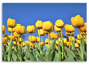 Obraz na plátne Žlté tulipány na lúke Rozmery: 60 x 40 cm