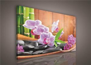 Obraz na plátne, rozmer 100 x 75 cm, orchidea, IMPOL TRADE 106O1