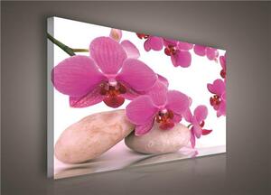 Obraz na plátne, rozmer 100 x 75 cm, orchidea ružová, IMPOL TRADE 136O1