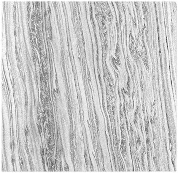 AKUSTICKÝ PANEL velikost: 52/52/0.7 cm Jangal - Online Only bytové doplnky, Online Only