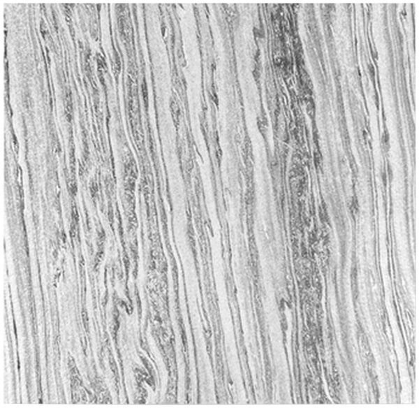 AKUSTICKÝ PANEL velikost: 52/52/0.7 cm Jangal - Online Only bytové doplnky, Online Only